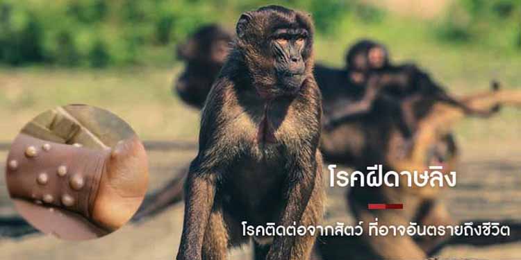 โรคฝีดาษลิง โรคติดต่อจากสัตว์ ที่อาจอันตรายถึงชีวิต!